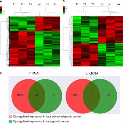 Identification of lncRNA and mRNA regulatory networks associated with gastric cancer progression